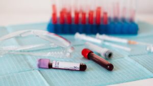 Blood collection tubes, syringes, and protective eyewear on a medical workspace, representing laboratory testing and diagnostic services.